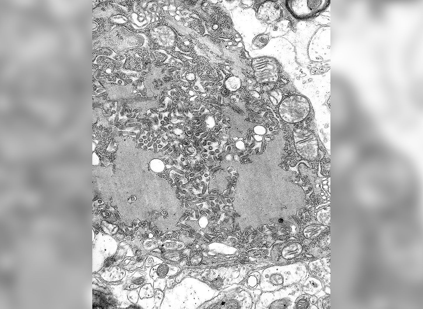 Что вызывает бешенство и как происходит заражение. Вирус бешенства под электронным микроскопом. Источник изображения: wikipedia.org. Фото.