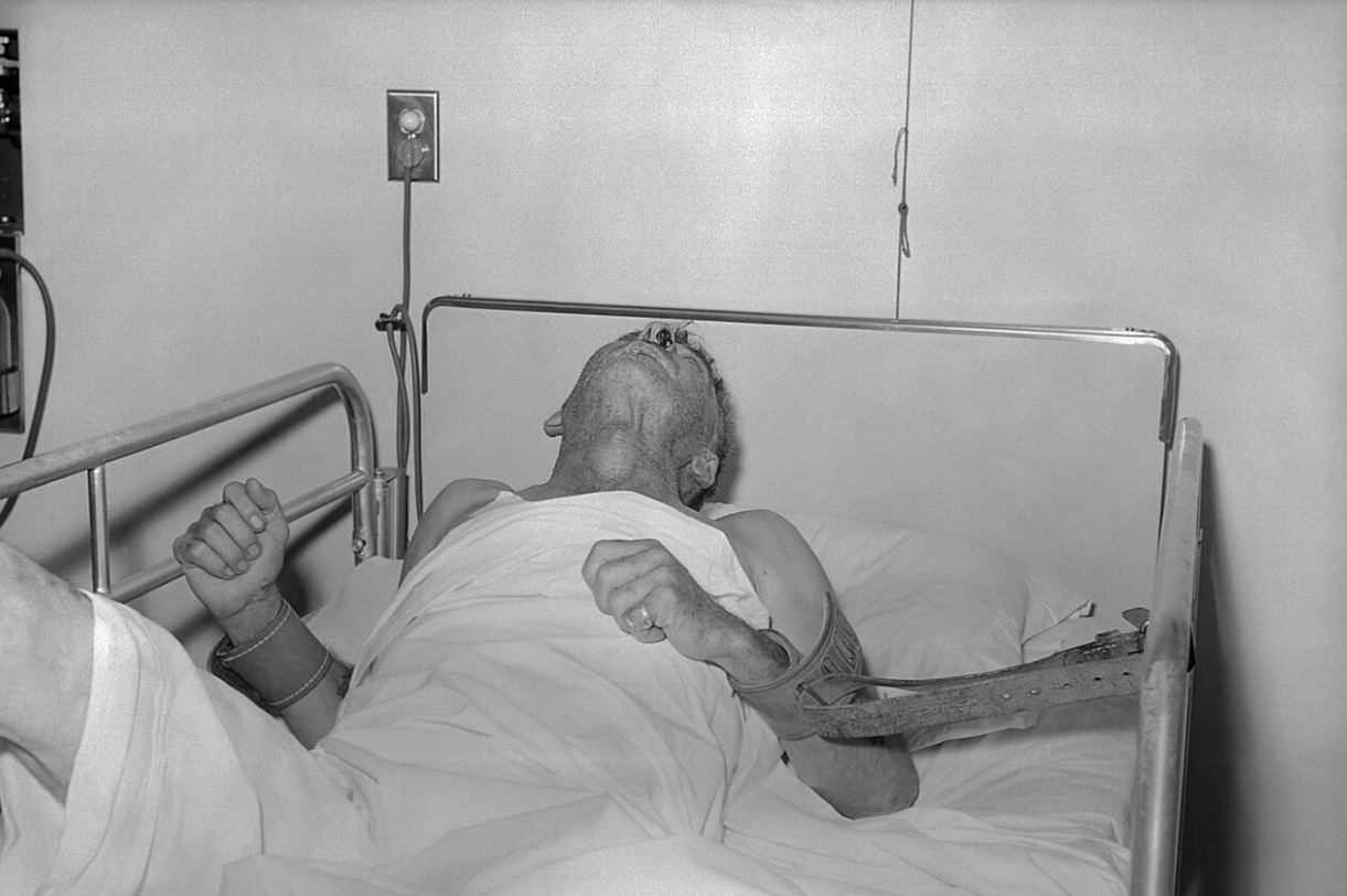 Почему бешенство убивает почти в 100% случаев. Человек с бешенством, фотография 1959 года. Источник изображения: wikipedia.org. Фото.