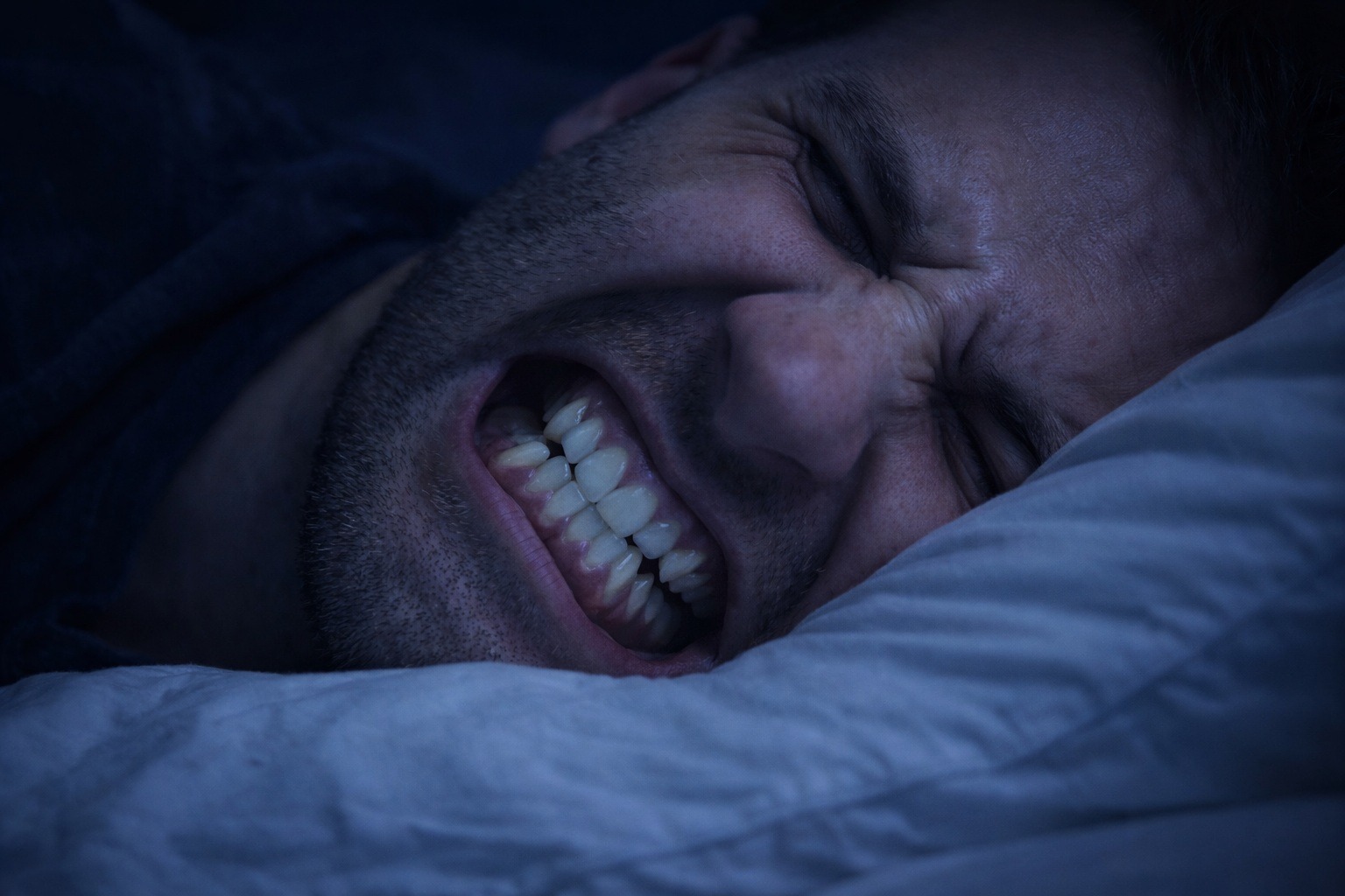 3 признака того, что вы скрипите зубами во сне
