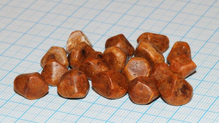 Что такое желчные камни и откуда они берутся. Желчные камни из холестерина. Источник изображения: wikipedia.org. Фото.