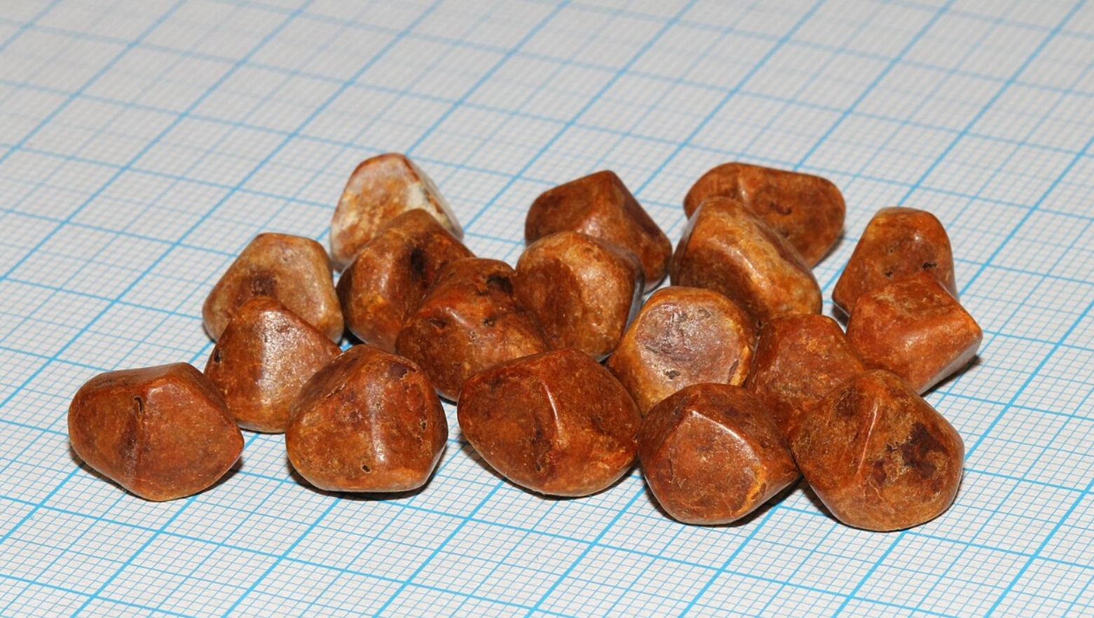 Что такое желчные камни и откуда они берутся. Желчные камни из холестерина. Источник изображения: wikipedia.org. Фото.