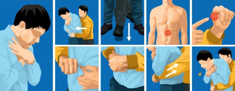 Как делать прием Геймлиха. Как делать прием Геймлиха в картинках. Источник изображения: squarespace.com. Фото.