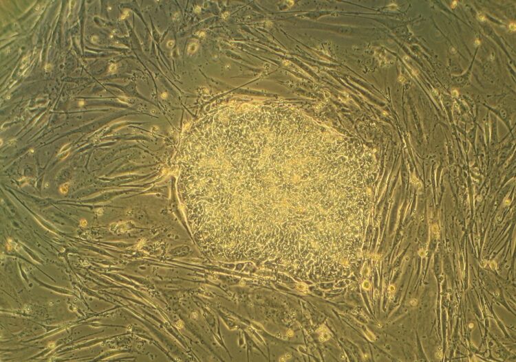В клонировании нет смысла. Эмбриональные стволовые клетки человека. Источник изображения: wikimedia.org. Фото.