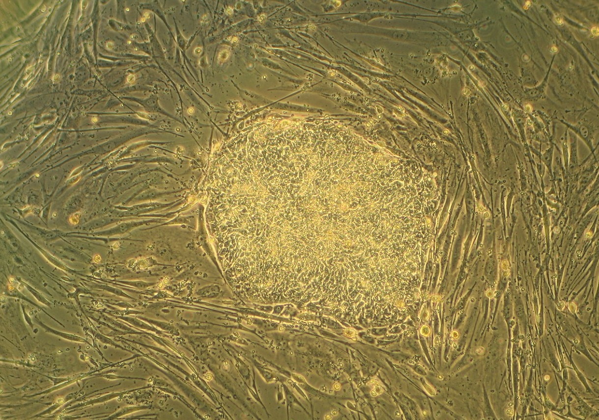 В клонировании нет смысла. Эмбриональные стволовые клетки человека. Источник изображения: wikimedia.org. Фото.