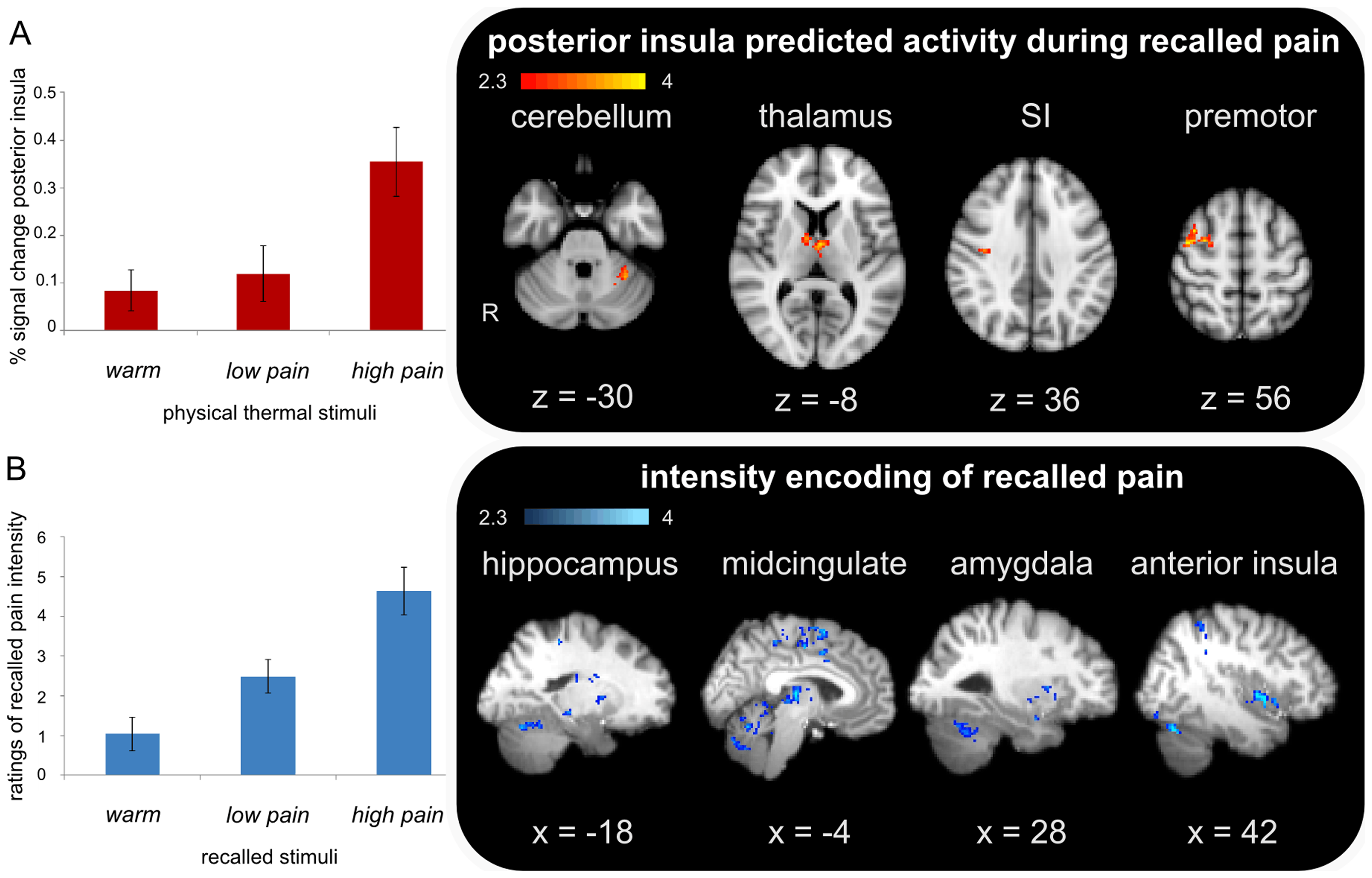 Как говорится, ожидание (B) и реальность (А). Обратите внимание, что шкала воображаемой/вспоминаемой боли (B) увеличена для компактности отображения. Источник изображения: journals.plos.org. Фото.