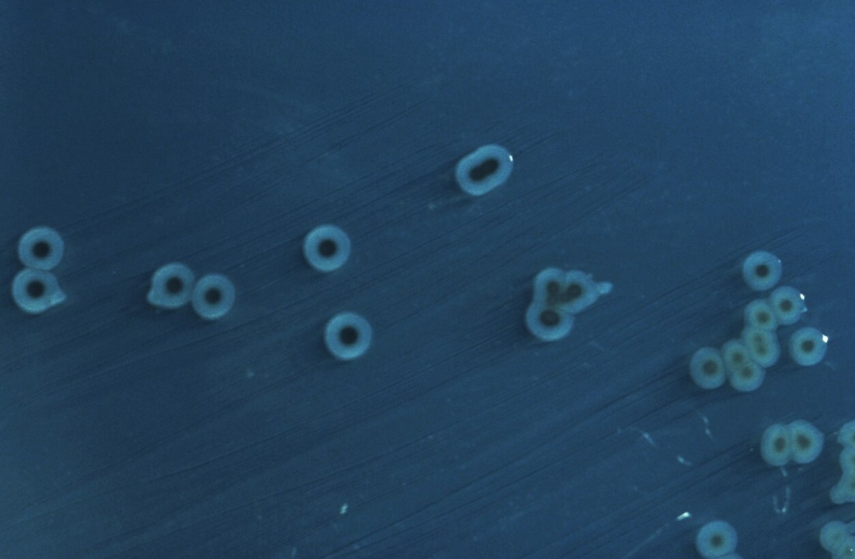 Что такое брюшной тиф. Колония возбудителей брюшного тифа, Источник изображения: wikipedia.org. Фото.