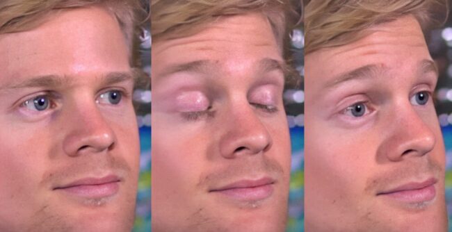 Почему мы не замечаем, как моргаем? Фото.