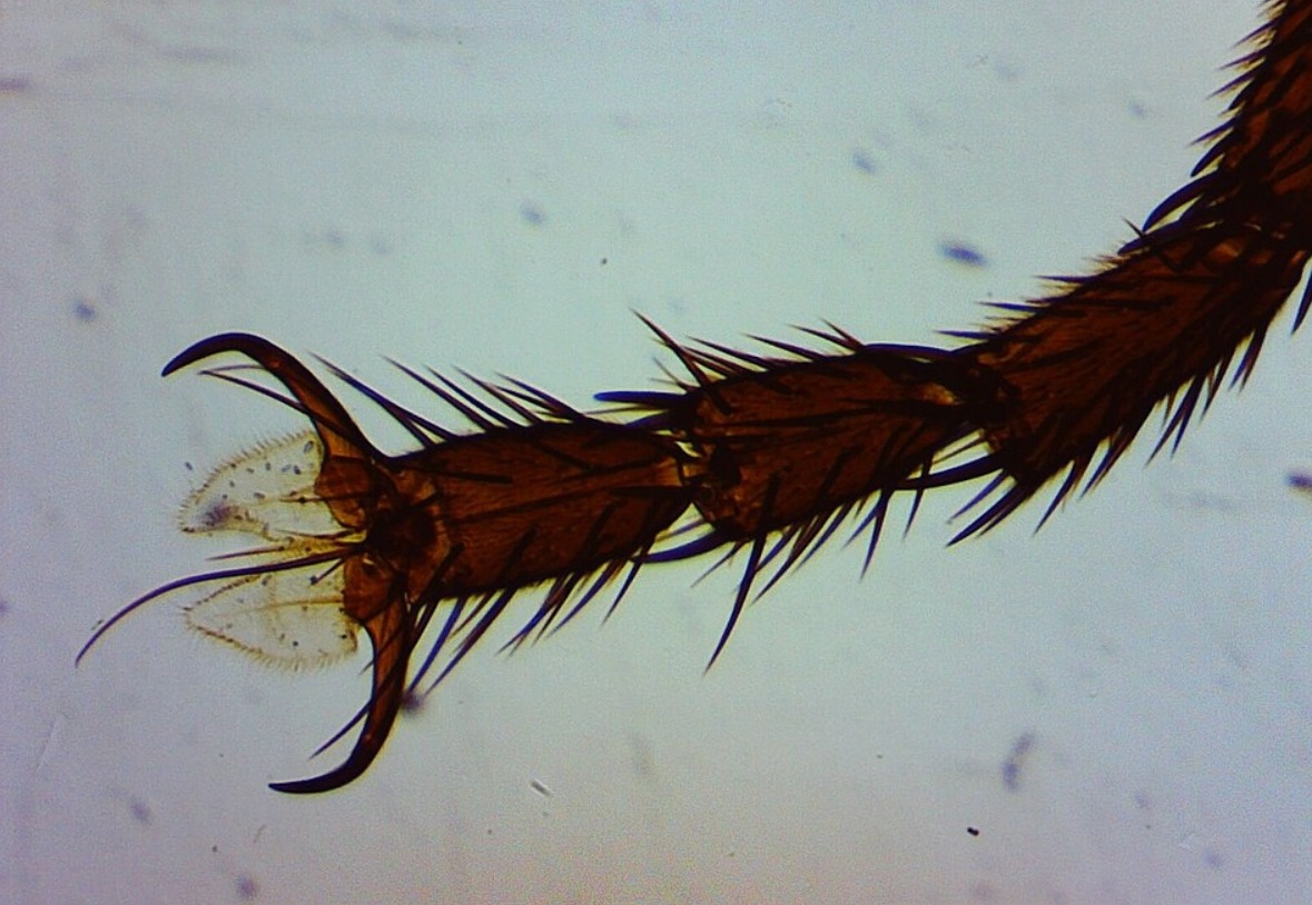 Почему мухи часто моются. Лапа мухи под микроскопом. Источник изображения: wikimedia.org. Фото.