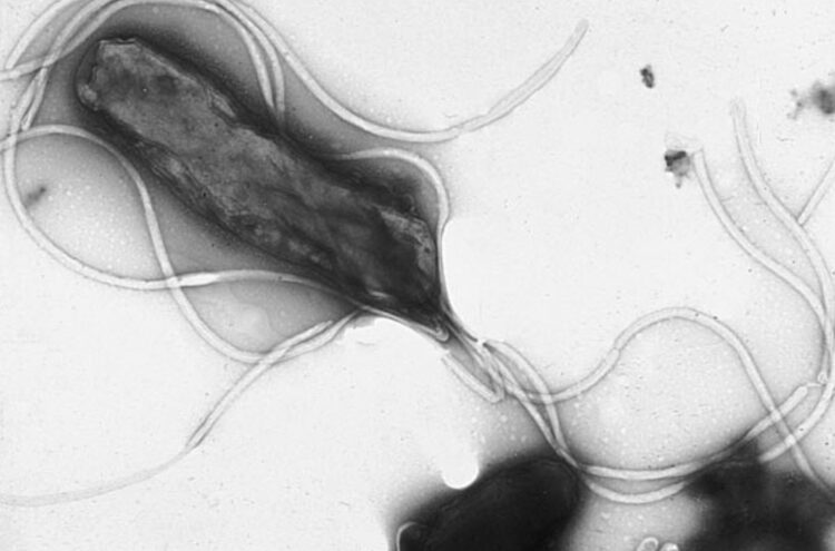 Кто такой Барри Маршалл и что он нашел в желудке. Бактерия Helicobacter pylori под микроскопом. Источник изображения: wikimedia.org. Фото.