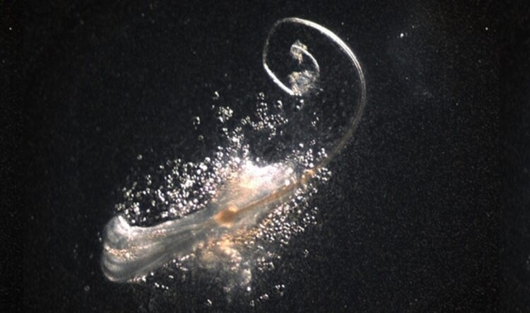 Новый способ лечения облысения. Волосяной фолликул — это не просто трубочка с волосом. Это мини-орган, в котором одновременно работают несколько типов стволовых клеток. Источник изображения: sciencealert.com. Фото.