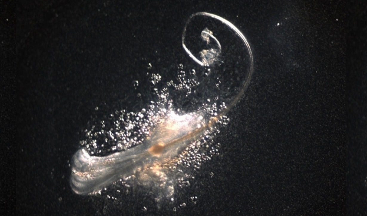 A New Method for Treating Baldness. A hair follicle is not just a tube with hair. It's a mini-organ in which several types of stem cells work simultaneously. Image source: sciencealert.com. Photo.