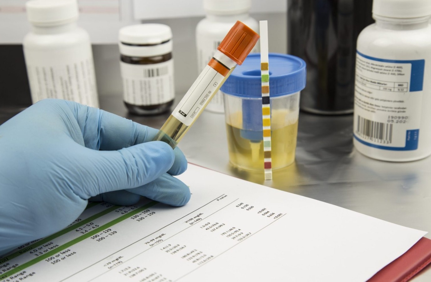 Оттенок мочи напрямую зависит от количества выпитой воды. Фото.