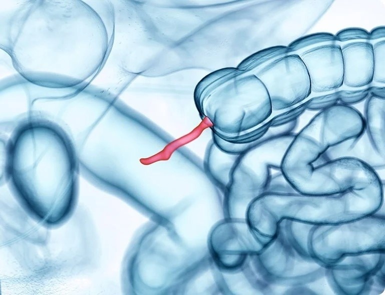 Что такое аппендикс и зачем он нужен человеку. Аппендикс похож на маленький тупиковый карман. Но именно в этом «тупике» прячется целая колония полезных бактерий. Источник изображения: news-medical.net. Фото.