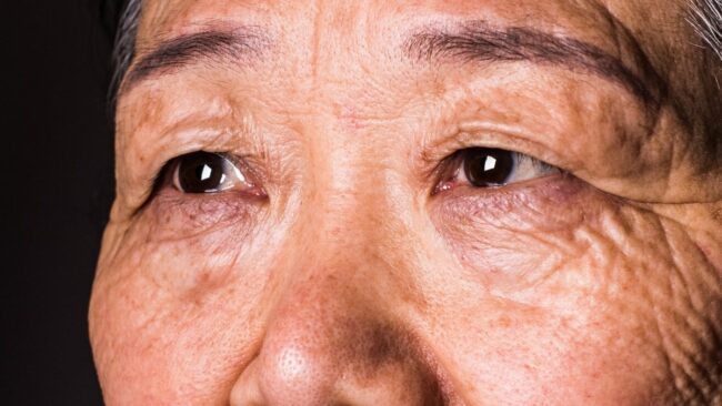 По глазам можно выявить опасную болезнь за 12 лет до первых симптомов. Фото.