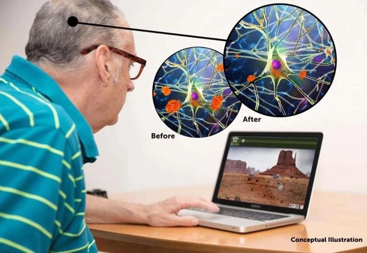 Концепт-арт, демонстрирующий, как тренировка BrainHQ может уменьшить количество амилоидных бляшек в мозге (показаны оранжевым цветом). Фото.