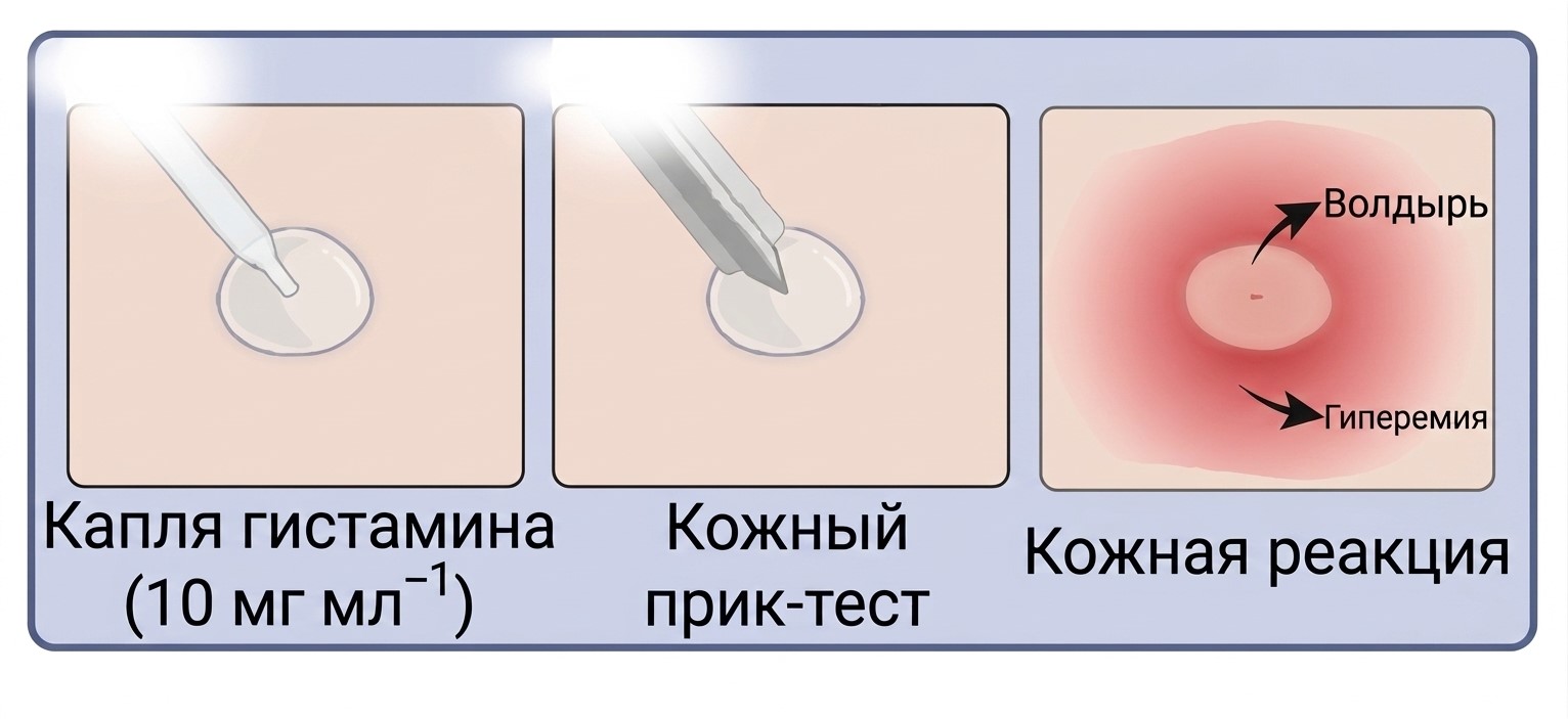 Схема проведения кожной пробы с гистамином. Фото.