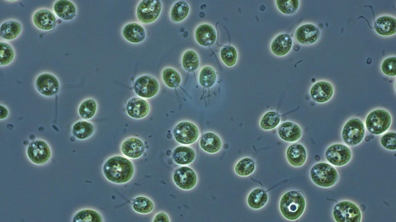 Одноклеточные водоросли Chlamydomonas reinhardtii под микроскопом. Именно изучение их реакции на свет привело к открытию каналродопсинов.